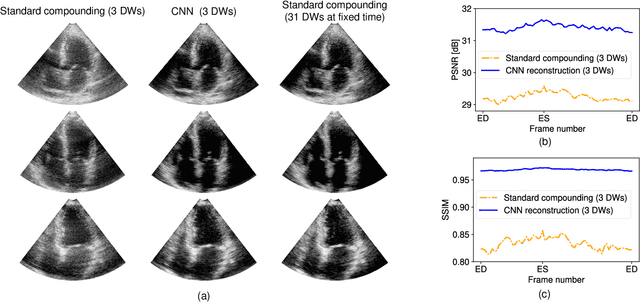 Figure 3 for Ultrafast Cardiac Imaging Using Deep Learning For Speckle-Tracking Echocardiography