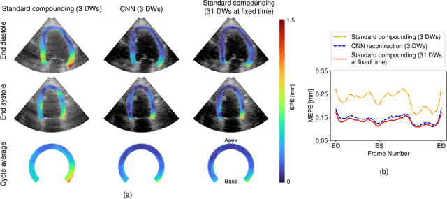 Figure 4 for Ultrafast Cardiac Imaging Using Deep Learning For Speckle-Tracking Echocardiography