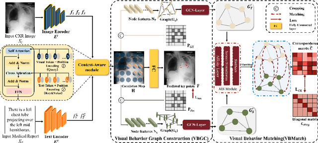 Figure 1 for GEM: Context-Aware Gaze EstiMation with Visual Search Behavior Matching for Chest Radiograph