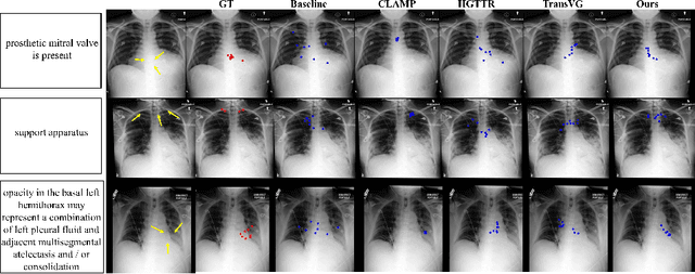 Figure 3 for GEM: Context-Aware Gaze EstiMation with Visual Search Behavior Matching for Chest Radiograph