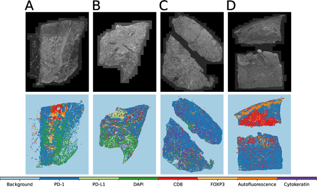 Figure 3 for Fluoroformer: Scaling multiple instance learning to multiplexed images via attention-based channel fusion