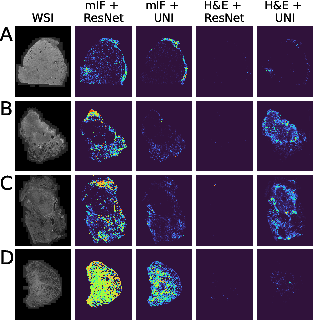 Figure 4 for Fluoroformer: Scaling multiple instance learning to multiplexed images via attention-based channel fusion