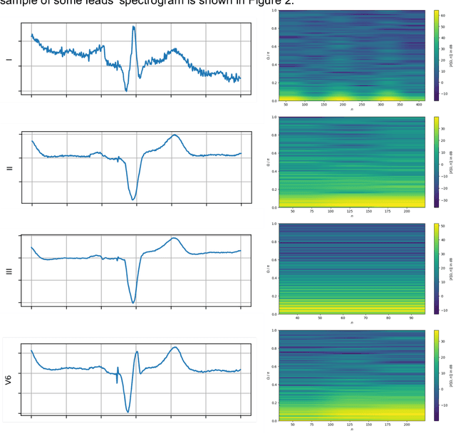 Figure 3 for A new method using deep learning to predict the response to cardiac resynchronization therapy