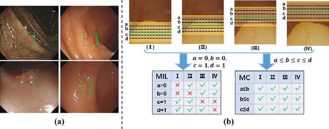 Figure 1 for MonoBox: Tightness-free Box-supervised Polyp Segmentation using Monotonicity Constraint