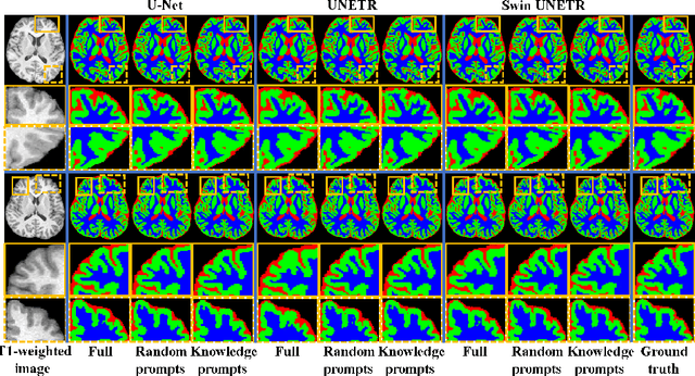 Figure 4 for Knowledge-Guided Prompt Learning for Lifespan Brain MR Image Segmentation