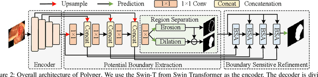 Figure 2 for Polyper: Boundary Sensitive Polyp Segmentation