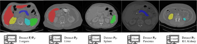 Figure 1 for Multi-site Organ Segmentation with Federated Partial Supervision and Site Adaptation