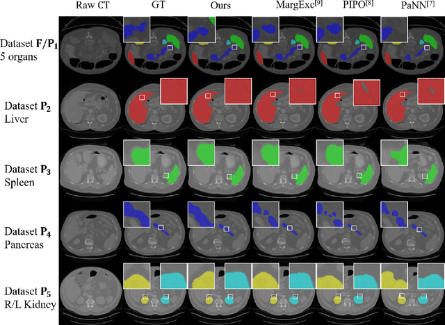 Figure 4 for Multi-site Organ Segmentation with Federated Partial Supervision and Site Adaptation