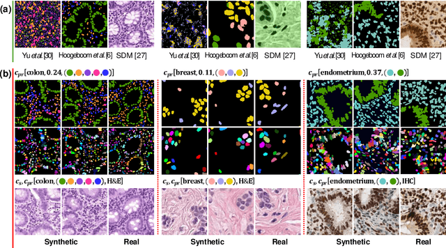 Figure 3 for Controllable and Efficient Multi-Class Pathology Nuclei Data Augmentation using Text-Conditioned Diffusion Models