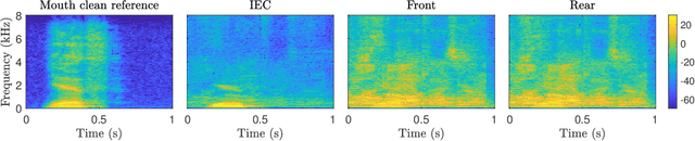 Figure 2 for Noise-Robust Hearing Aid Voice Control