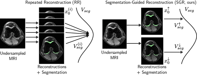 Figure 1 for Segmentation-guided MRI reconstruction for meaningfully diverse reconstructions