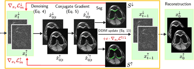 Figure 3 for Segmentation-guided MRI reconstruction for meaningfully diverse reconstructions