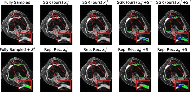 Figure 4 for Segmentation-guided MRI reconstruction for meaningfully diverse reconstructions