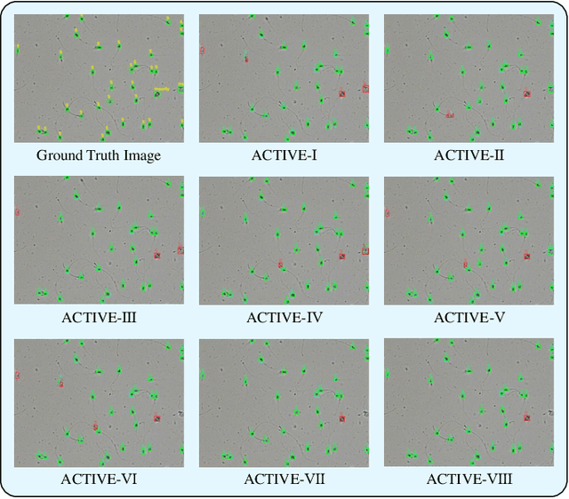 Figure 2 for ACTIVE: A Deep Model for Sperm and Impurity Detection in Microscopic Videos