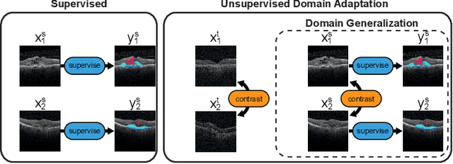 Figure 1 for Joint semi-supervised and contrastive learning enables zero-shot domain-adaptation and multi-domain segmentation