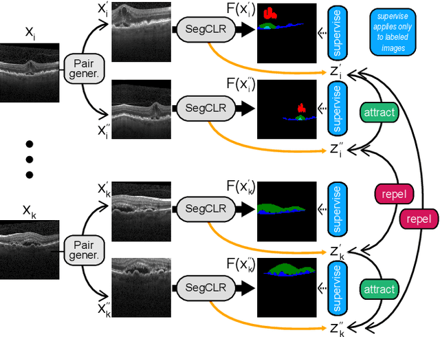 Figure 3 for Joint semi-supervised and contrastive learning enables zero-shot domain-adaptation and multi-domain segmentation