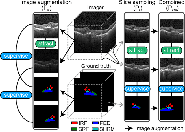 Figure 4 for Joint semi-supervised and contrastive learning enables zero-shot domain-adaptation and multi-domain segmentation