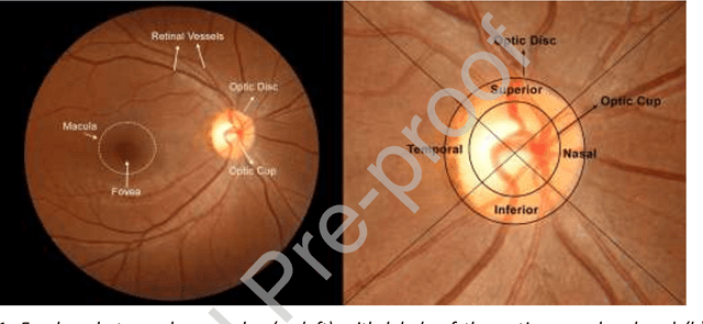 Figure 1 for Automatic detection of glaucoma via fundus imaging and artificial intelligence: A review