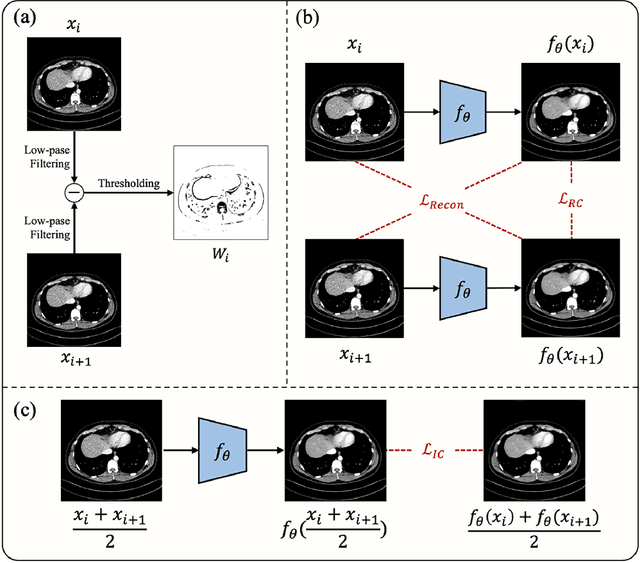 Figure 1 for Neighboring Slice Noise2Noise: Self-Supervised Medical Image Denoising from Single Noisy Image Volume