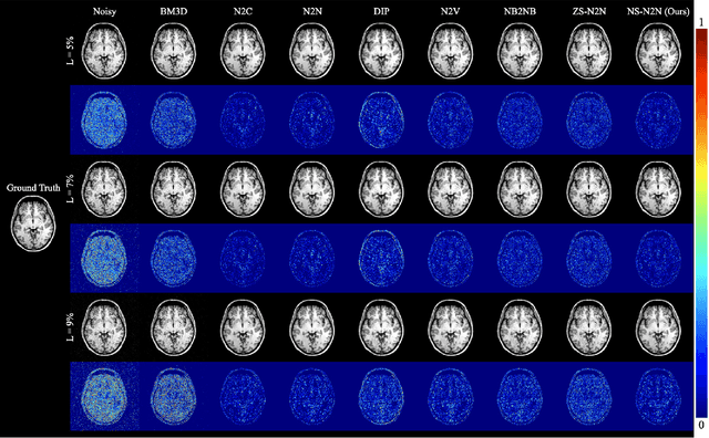 Figure 2 for Neighboring Slice Noise2Noise: Self-Supervised Medical Image Denoising from Single Noisy Image Volume