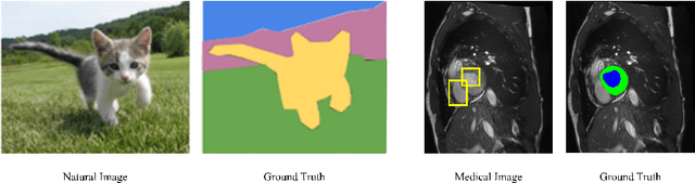 Figure 1 for Attention-Guided Perturbation for Consistency Regularization in Semi-Supervised Medical Image Segmentation