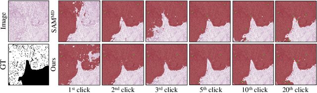 Figure 1 for Evaluation and improvement of Segment Anything Model for interactive histopathology image segmentation