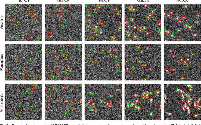 Figure 3 for Deep Joint Denoising and Detection for Enhanced Intracellular Particle Analysis