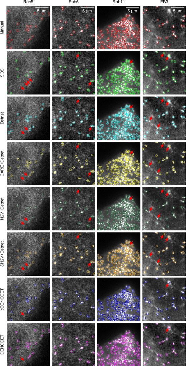 Figure 4 for Deep Joint Denoising and Detection for Enhanced Intracellular Particle Analysis