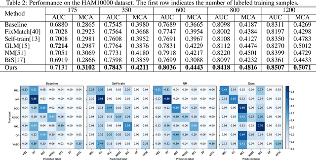 Figure 4 for Class-Specific Distribution Alignment for Semi-Supervised Medical Image Classification