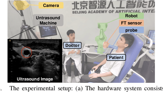 Figure 4 for A Unified Interaction Control Framework for Safe Robotic Ultrasound Scanning with Human-Intention-Aware Compliance