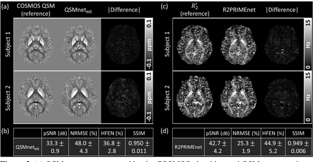 Figure 3 for $χ$-sepnet: Deep neural network for magnetic susceptibility source separation