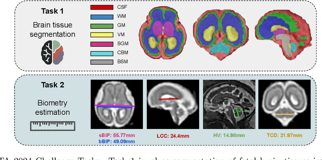 Figure 1 for Advances in Automated Fetal Brain MRI Segmentation and Biometry: Insights from the FeTA 2024 Challenge