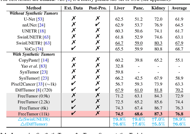 Figure 2 for FreeTumor: Advance Tumor Segmentation via Large-Scale Tumor Synthesis