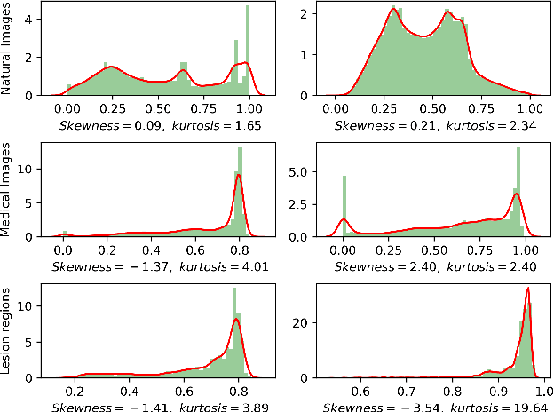 Figure 1 for Flattening Singular Values of Factorized Convolution for Medical Images