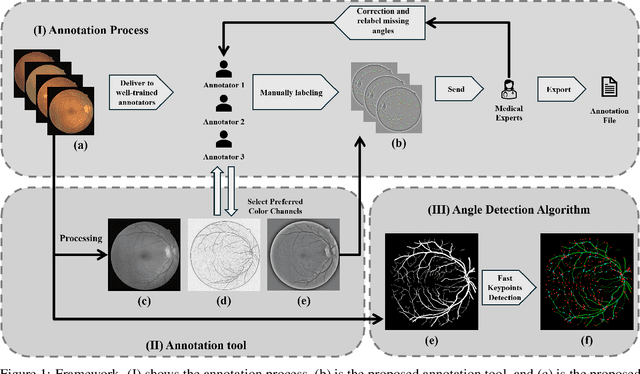 Figure 1 for RBAD: A Dataset and Benchmark for Retinal Vessels Branching Angle Detection
