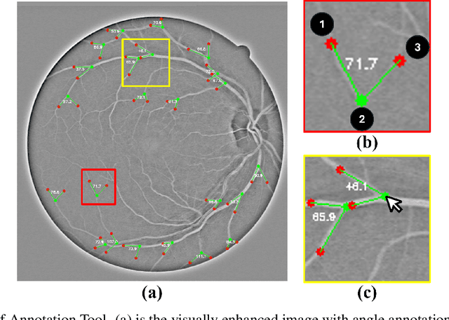 Figure 2 for RBAD: A Dataset and Benchmark for Retinal Vessels Branching Angle Detection
