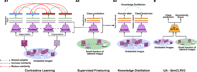 Figure 1 for Uncertainty Awareness Enables Efficient Labeling for Cancer Subtyping in Digital Pathology