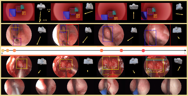 Figure 3 for Vision-Based Neurosurgical Guidance: Unsupervised Localization and Camera-Pose Prediction