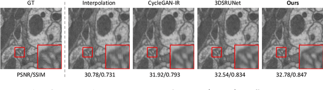 Figure 3 for DiffuseIR:Diffusion Models For Isotropic Reconstruction of 3D Microscopic Images