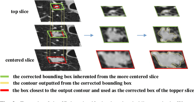 Figure 4 for A Coarse-to-fine Morphological Approach With Knowledge-based Rules and Self-adapting Correction for Lung Nodules Segmentation