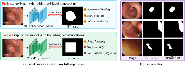 Figure 1 for WeakPolyp: You Only Look Bounding Box for Polyp Segmentation