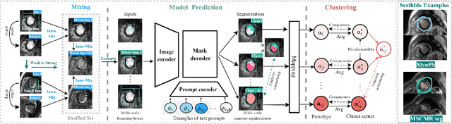 Figure 1 for MedCL: Learning Consistent Anatomy Distribution for Scribble-supervised Medical Image Segmentation