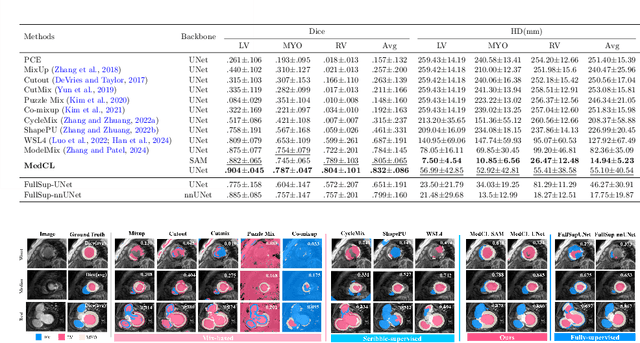 Figure 2 for MedCL: Learning Consistent Anatomy Distribution for Scribble-supervised Medical Image Segmentation