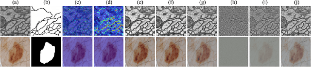 Figure 1 for XNet v2: Fewer Limitations, Better Results and Greater Universality