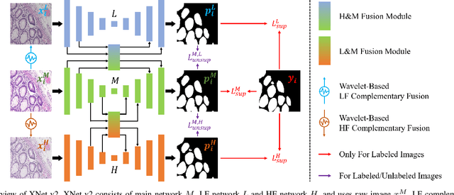 Figure 2 for XNet v2: Fewer Limitations, Better Results and Greater Universality