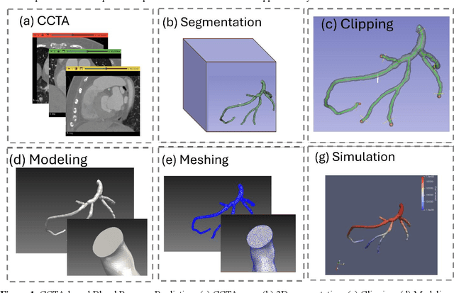 Figure 1 for Blood Pressure Prediction for Coronary Artery Disease Diagnosis using Coronary Computed Tomography Angiography