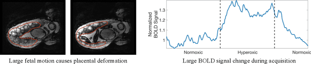 Figure 1 for Shape-aware Segmentation of the Placenta in BOLD Fetal MRI Time Series