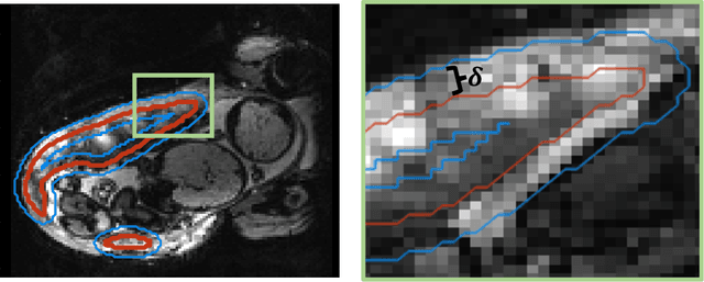 Figure 3 for Shape-aware Segmentation of the Placenta in BOLD Fetal MRI Time Series