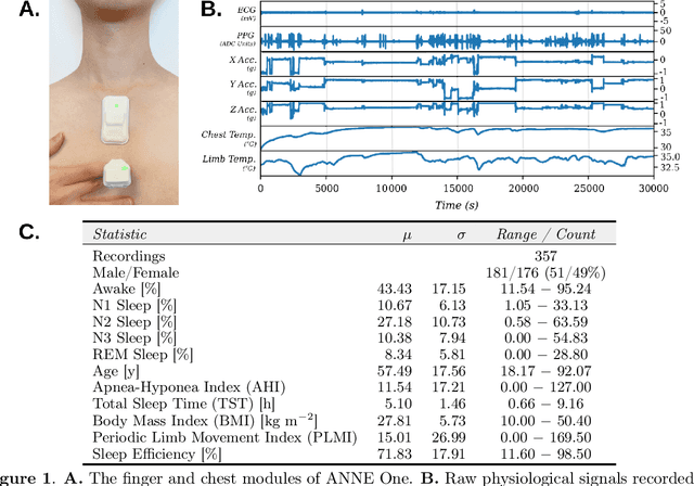 Figure 1 for Mamba-based Deep Learning Approaches for Sleep Staging on a Wireless Multimodal Wearable System without Electroencephalography