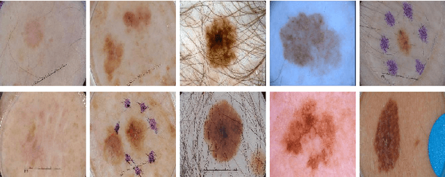 Figure 1 for TESL-Net: A Transformer-Enhanced CNN for Accurate Skin Lesion Segmentation